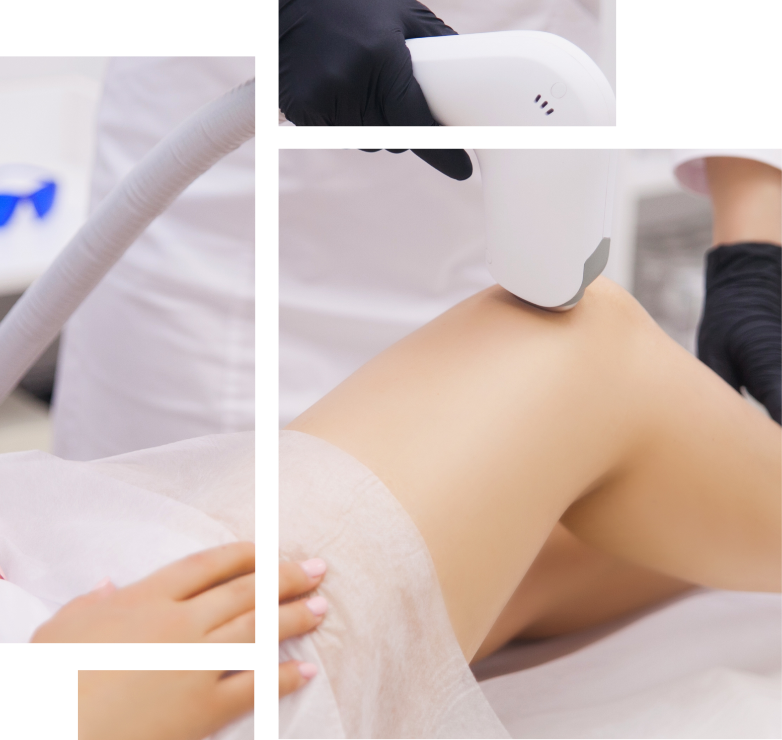 Hair Removal Image