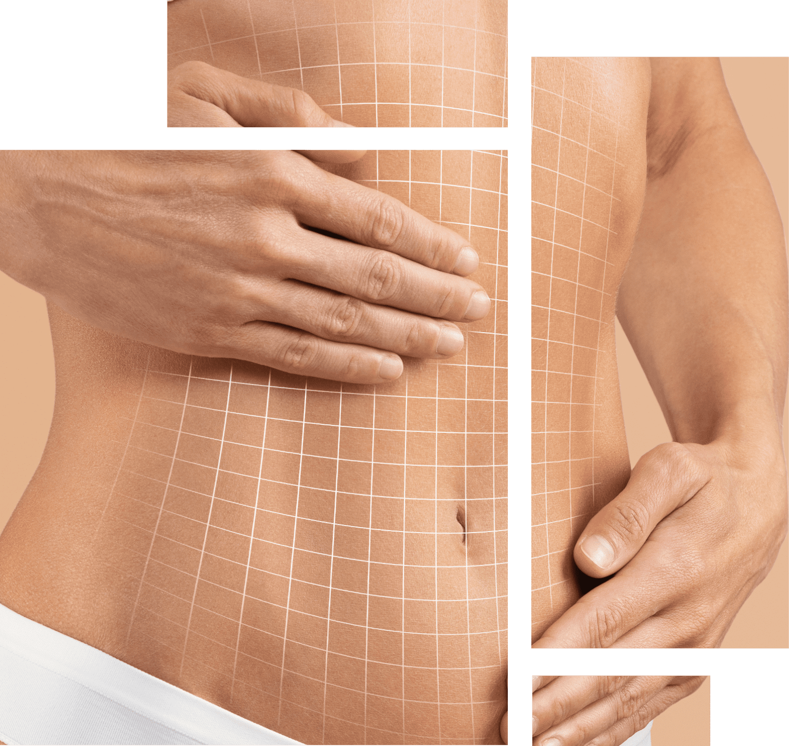 Tummy Tuck Image