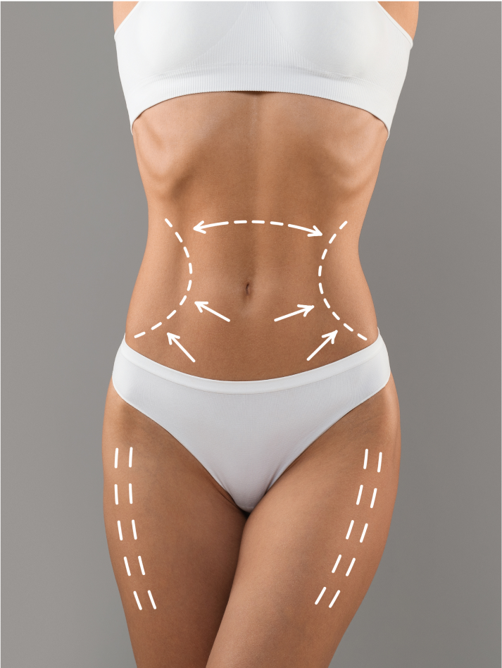 Liposuction techniques Image