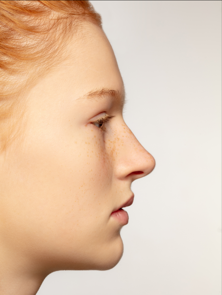 Rhinoplasty Reasons Image