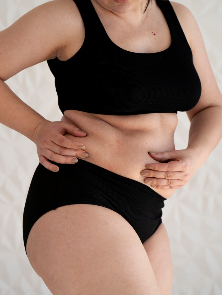 Tummy Tuck Benefits Image