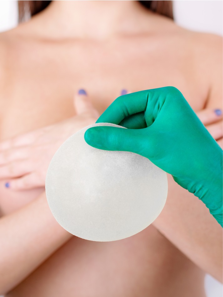 Breast augmentation Image