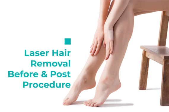 Laser Hair Removal- Before and Post Procedure