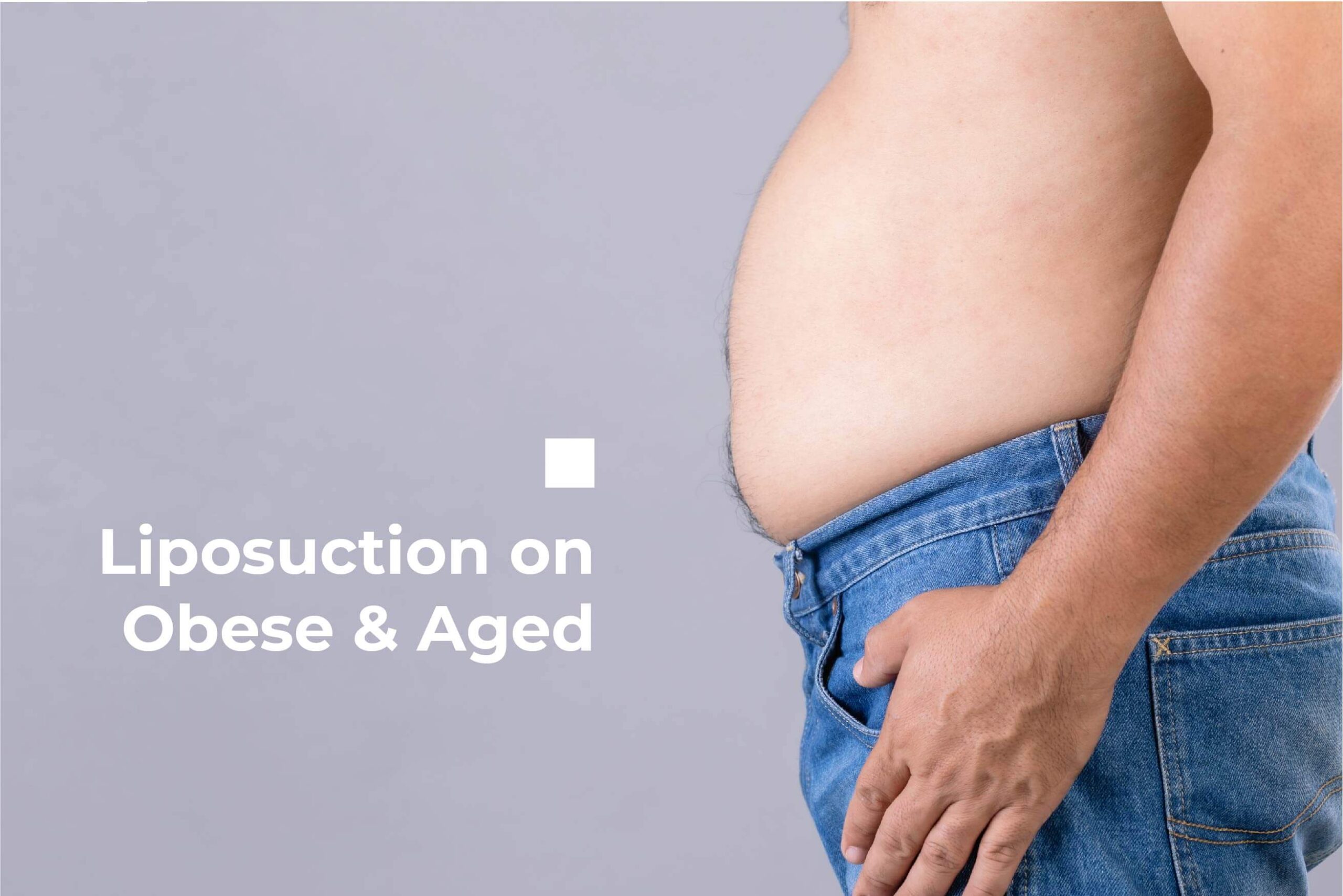 Liposuction on Obese and Aged