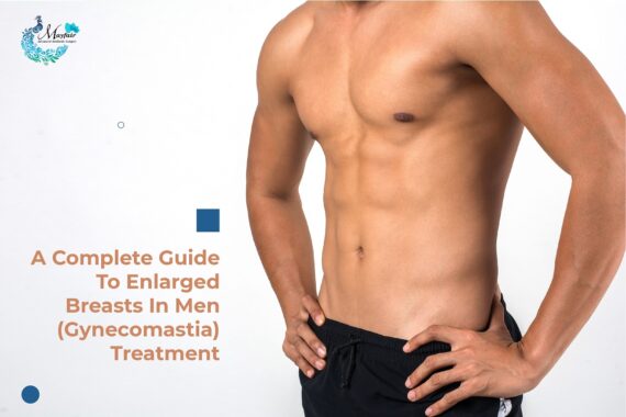 A Complete Guide To Enlarged Breasts In Men (Gynecomastia) Treatment