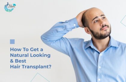How To Get a Natural Looking and Best Hair Transplant?
