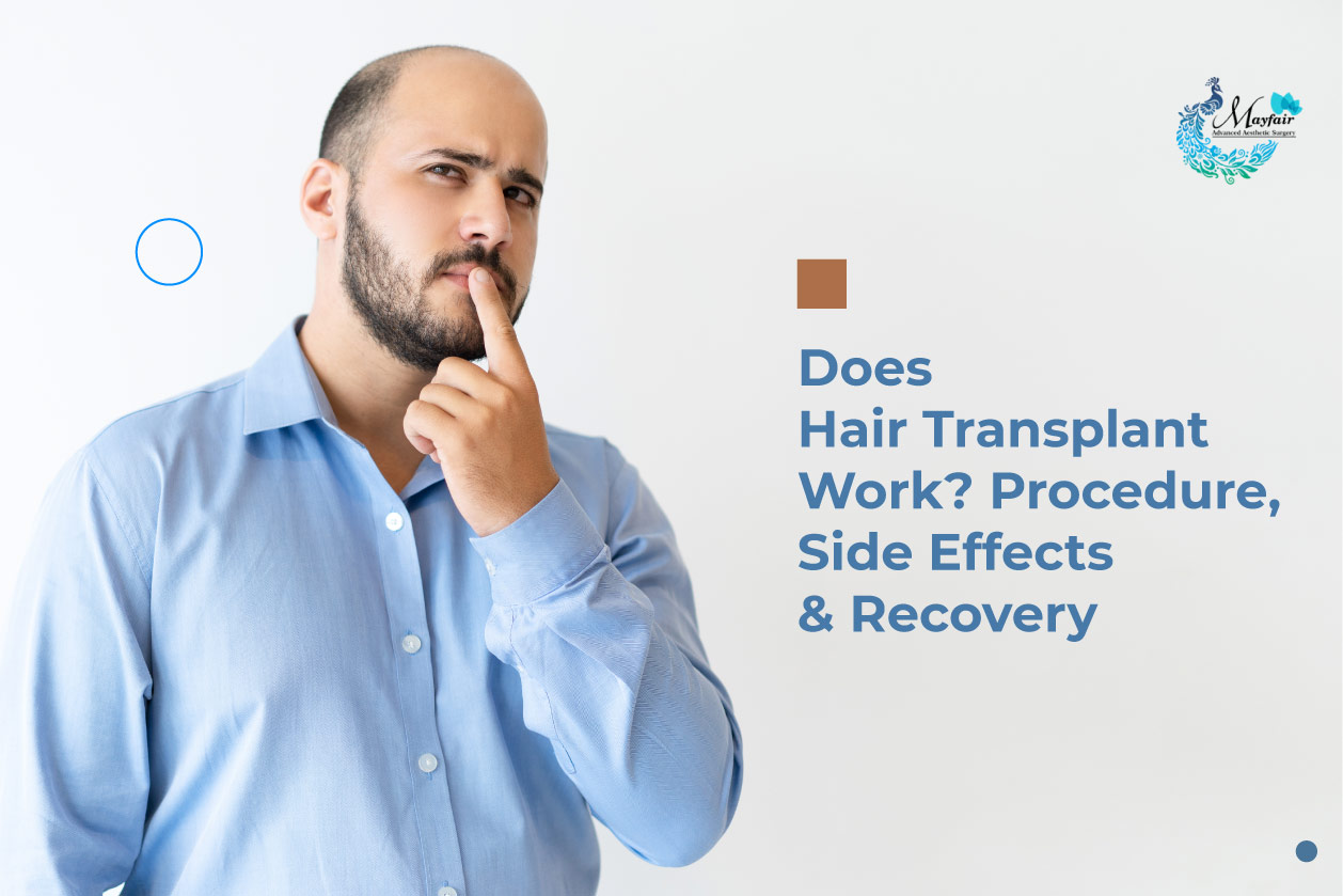 Hair Transplant Procedure, Side effects and recovery - Mayfair Aesthetics