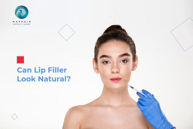 A girl is getting injected in face for natural looking lip filler