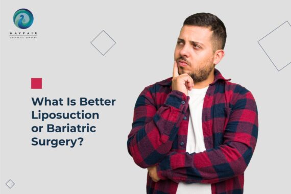 A guy thinking about liposuction and bariatric surgery