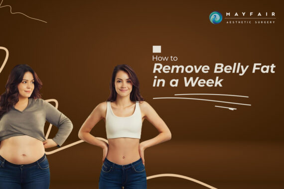 Before and after comparison of a woman showing successful belly fat removal results in a week, with the title 'How to Remove Belly Fat in a Week' and branding by Mayfair Aesthetic Surgery.