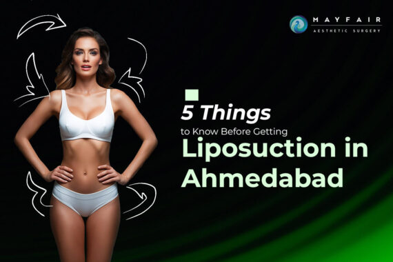 Fat Removal Treatment: Image of a confident woman showcasing a well-toned body, highlighting the topic '5 Things to Know Before Getting Liposuction in Ahmedabad.' The visual emphasizes aesthetic results achievable through liposuction with arrows indicating targeted areas for fat reduction. Presented by Mayfair Aesthetic Surgery.