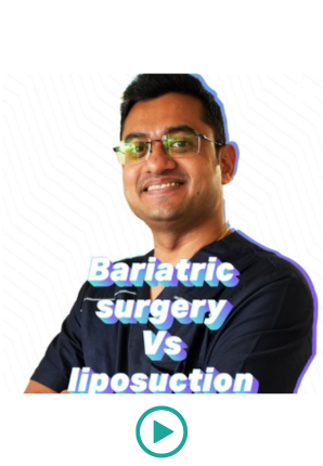 Bariatric Surgery Vs liposuction